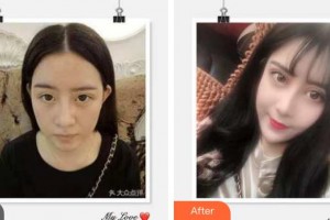 成都美卿醫(yī)療美容醫(yī)院達(dá)文整形價格表附瘦臉案例展示