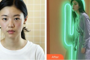 成都如悅醫(yī)療美容醫(yī)院李洋整形價格表附面部輪廓案例展示