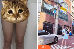 廣州晨曦醫(yī)療美容醫(yī)院李碩埈整形價(jià)格表附美體塑形案例展示