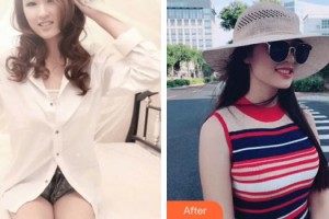 成都晶都醫(yī)療美容醫(yī)院王教授整形價(jià)格表附豐胸案例展示