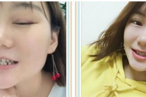 成都茁悅口腔診所陸開盛整形價(jià)格表附牙綜合案例展示