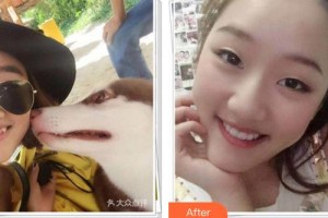 成都華廈眼科醫(yī)院張學(xué)進(jìn)整形價(jià)格表附牙齒矯正案例展示