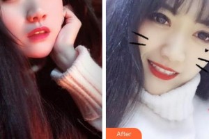 成都茁悅口腔診所李琴整形價(jià)格表附牙齒美白案例展示