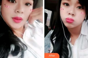 成都亞非牙科醫(yī)院李顯軍整形價格表附冷光美白案例展示