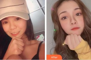 成都華蜀眼科門診部陳來華整形價格表附眼部綜合案例展示