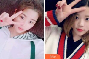 成都純?？谇辉\所馬華鈺整形價格表附冷光美白案例展示