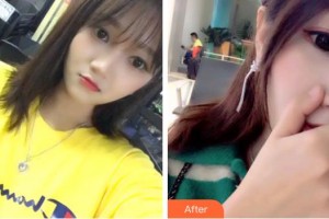 成都純?？谇辉\所劉純虎整形價格表附超聲波潔牙案例展示