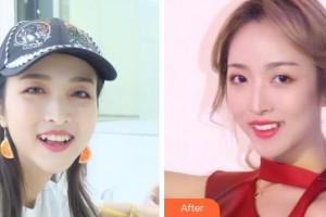 成都皓雅口腔門診部董立梅整形價格表附牙齒美白案例展示