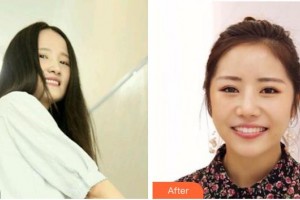 成都皓雅口腔門(mén)診部陸相華整形價(jià)格表附牙綜合案例展示