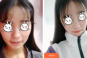 福建武警總隊(duì)醫(yī)院激光美容中心李碧容整形價(jià)格表附無針?biāo)獍咐故?>
</a>
<h3 class=