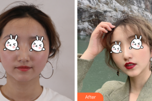 廣州尚美善造美容醫(yī)院張經(jīng)祥整形價(jià)格表附光子嫩膚案例展示