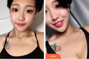 福建醫(yī)科大學(xué)附屬第一醫(yī)院整形美容外科黃循鐳整形價(jià)格表附濃縮豐胸真實(shí)案例展示