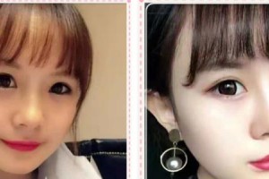 福州中聯(lián)美康整形美容醫(yī)院陳龍整形價(jià)格表附面部吸脂項(xiàng)目案例展示