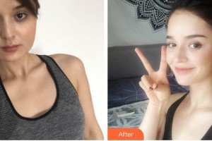 福州愛思特醫(yī)療美容醫(yī)院曾小梅整形價格表附激光美膚激光祛斑案例展示