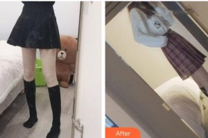 福州隆美爾整形美容醫(yī)院王楨整形價格表附大腿吸脂案例展示