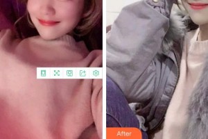 福州格萊美醫(yī)療美容醫(yī)院劉飛順整形價(jià)格表附牙綜合案例展示