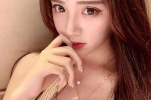 重慶愛思特整形美容醫(yī)院向雪岑整形價格表附埋線提升案例展示