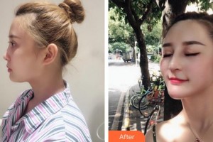 董新整形價(jià)格表附活力少女速成寶典案例展示