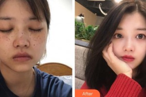 廈門(mén)張銘整醫(yī)療美容診所張小玲整形價(jià)格表附激光美膚案例展示