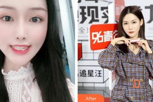 李博整形價(jià)格表附牙齒矯正案例展示