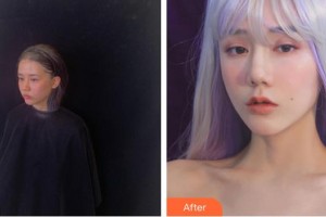 廈門華美名媛整形美容醫(yī)院郭震整形價格表附熱瑪吉案例展示