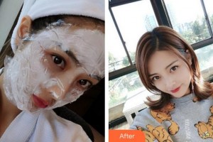 廈門臉博士整形醫(yī)院馬麗整形價格表附熱瑪吉案例展示