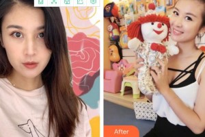 廈門修志夫整形美容醫(yī)院林清福整形價格表附熱瑪吉案例展示