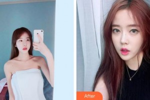 廈門(mén)蔡懿醫(yī)療美容診所李慧善整形價(jià)格表附鼻部手術(shù)案例展示