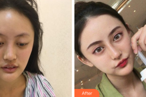 廣州中家醫(yī)家庭醫(yī)生醫(yī)學(xué)整形美容醫(yī)院大橋菜都子整形價(jià)格表附鼻部綜合案例展示