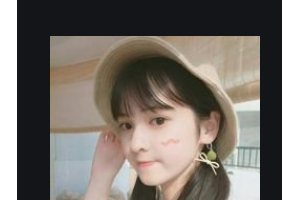 宜昌前衛(wèi)整形美容門診部李艷整形價(jià)格表附玻尿酸墊下巴案例展示