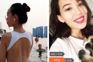 廈門峰煜口腔門診部林光毅整形價(jià)格表附牙齒矯正案例展示