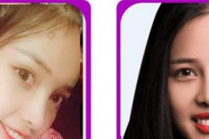 廈門康爾口腔門診部蘇明真整形價(jià)格表附牙齒貼面案例展示