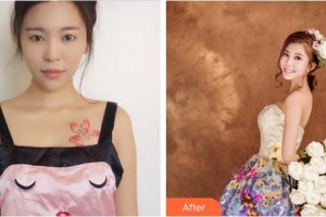 莆田少珍整形美容醫(yī)院祁少珍整形價格表附隆胸日記案例展示