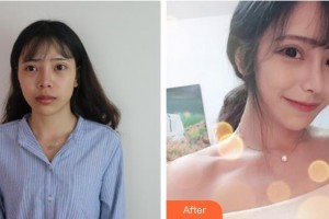 三明萬國美萊醫(yī)療美容外科門診部柯于清整形價(jià)格表附隆鼻修復(fù)案例展示