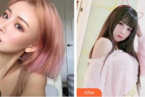 泉州星念醫(yī)療美容門診部蘇月明整形價格表附假體隆胸部案例展示