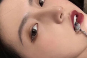 西安美立方整形美容醫(yī)院金寶玉整形價(jià)格表附面部吸脂案例展示