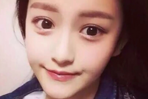 西安市邵醫(yī)生整形美容診所邵錦弘整形價(jià)格表附V-LINE瓜子瘦臉手術(shù)案例展示