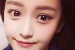 西安高一生醫(yī)療美容醫(yī)院高秀梅整形價(jià)格表附減脂案例展示