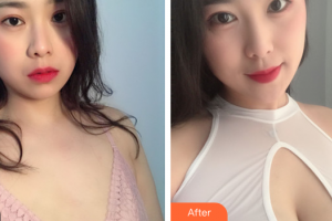 廣州南珠醫(yī)療美容門(mén)診部蔣海軍整形價(jià)格表附自體脂肪隆胸案例展示