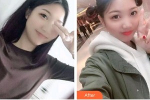 漳州衛(wèi)生職業(yè)學(xué)院附屬口腔醫(yī)院吳天昊整形價格表附牙齒根管調(diào)節(jié)案例展示