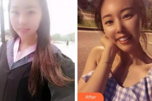 漳州衛(wèi)生職業(yè)學(xué)院附屬口腔醫(yī)院魏婷婷整形價格表附陶瓷矯正牙齒案例展示