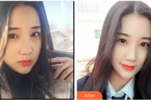 漳州衛(wèi)生職業(yè)學(xué)院附屬口腔醫(yī)院周曉琴整形價格表附冷光美白案例展示