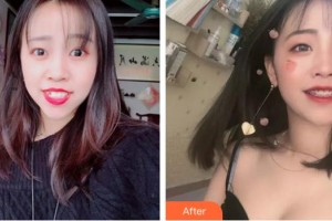 漳州衛(wèi)生職業(yè)學(xué)院附屬口腔醫(yī)院林垚靚整形價格表附牙齒矯正案例展示