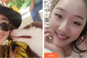 漳州南健口腔門診部林藝妹整形價格表附牙齒隱形矯正案例展示