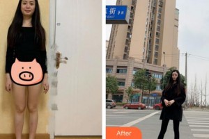 南平時光醫(yī)療美容門診部朱園靜整形價格表附吸脂瘦大腿案例展示