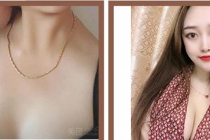 南平時光醫(yī)療美容門診部王召克整形價格表附隆胸案例展示