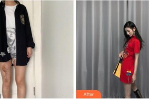 龍巖華美醫(yī)療美容醫(yī)院蔡乃鑫整形價(jià)格表附增生疤痕案例展示