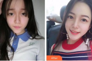 安徽韓美整形美容醫(yī)院何倫整形價格表附眼部手術(shù)案例展示