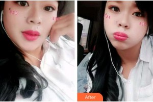 安徽韓美整形美容醫(yī)院王凱整形價格表附冷光美白案例展示