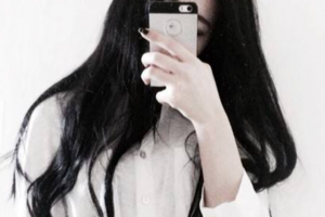 西安交通大學口腔醫(yī)院口腔頜面外科侯成群整形價格表附肋軟骨隆鼻案例展示